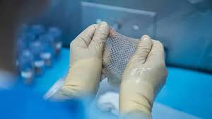 Skin Bank for Burn Patients